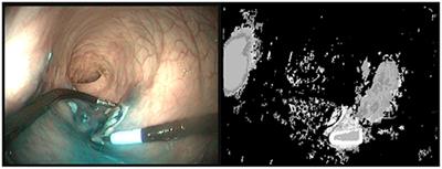 Combining Differential Kinematics and Optical Flow for Automatic Labeling of Continuum Robots in Minimally Invasive Surgery